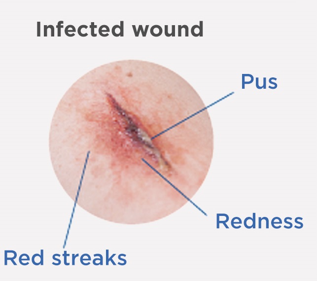Clinical Case with Non-healing Wound