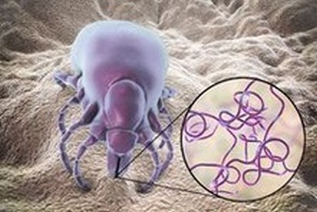 Borrelia (Lyme disease) and clinical cases