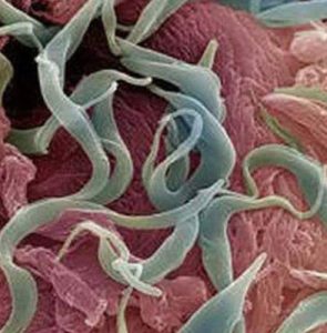 Parasites in the Human Body, Temperate Climate – Part 2